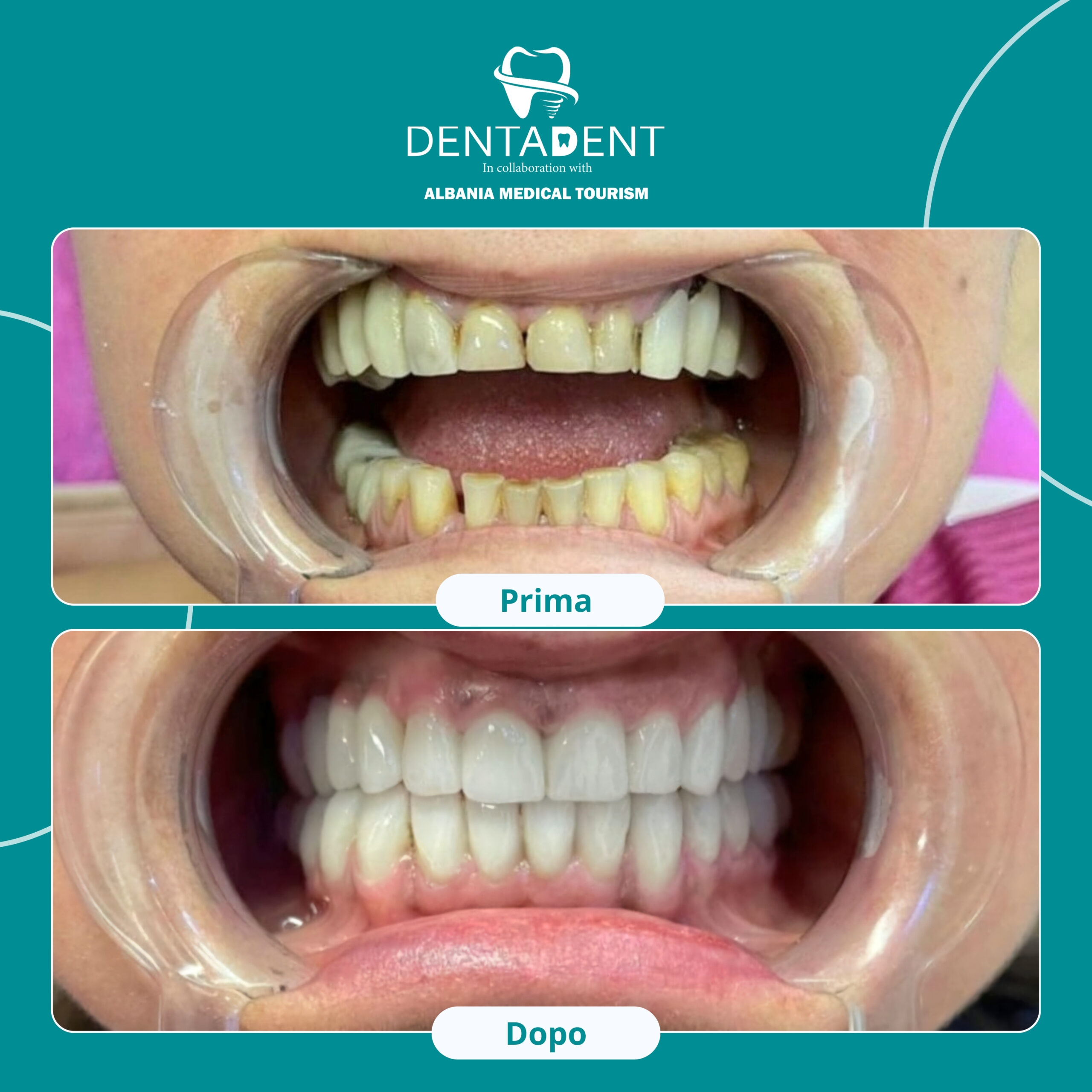 https://dentadent.uk/wp-content/uploads/2025/01/Blue-and-Green-Gradient-Dental-Instagram-Post_20241120_110444_0000-scaled.jpg