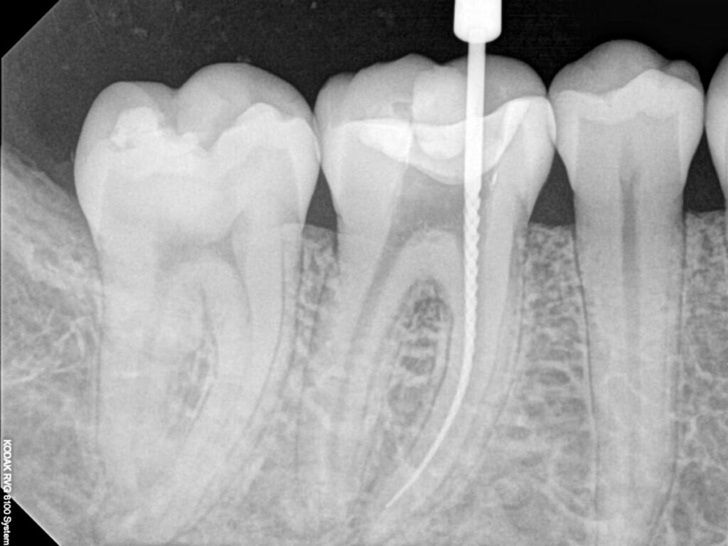 https://dentadent.uk/wp-content/uploads/2025/01/endodoncia_1-1024x768-1.jpg